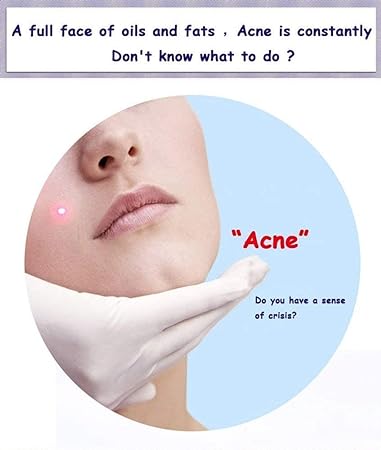 BIOAQUA 30ml Anti Acne Serum, Hydrating Oil Control Nourishing Facial Treatment